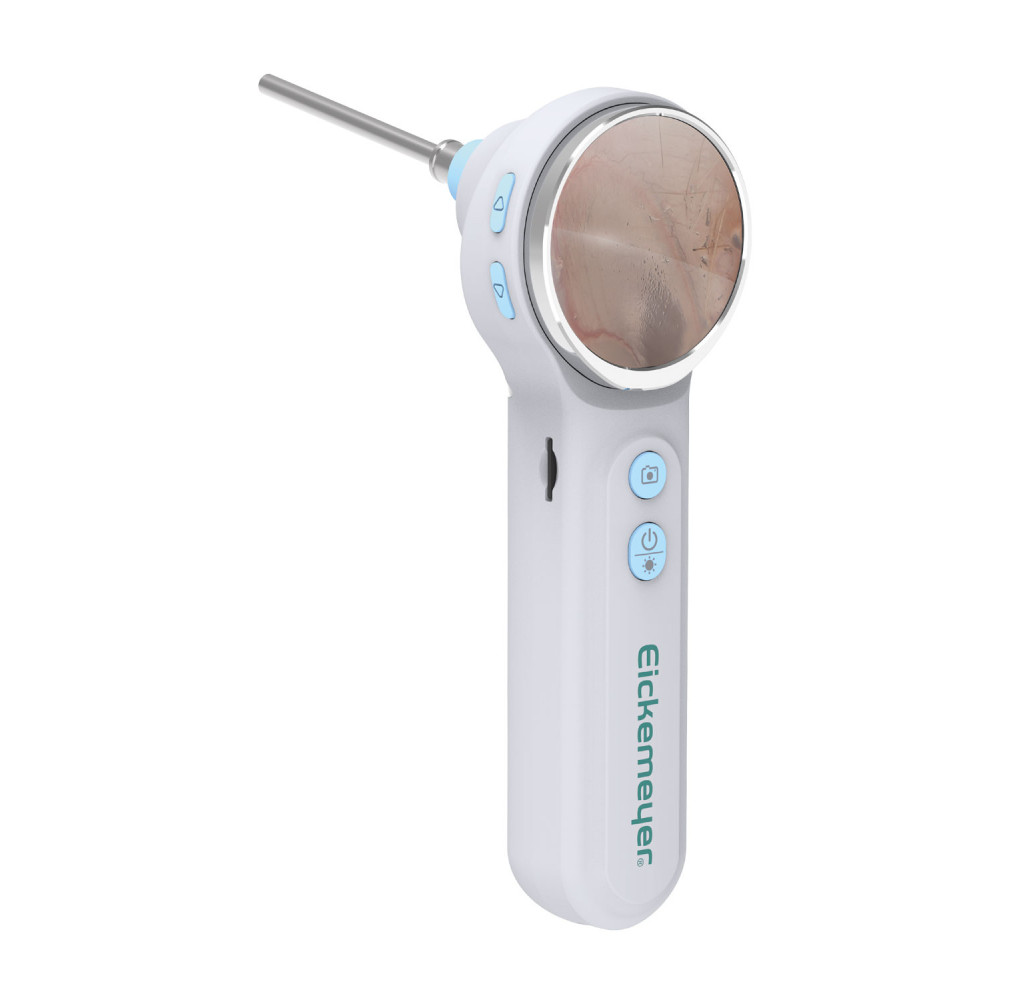 Video-otosocpio Eickview